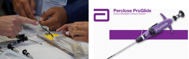 abbott_perclose_proglide_bonameda_distributor_3