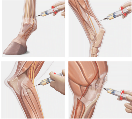 arthrex-dvigubo-svirksto-sistema-prp-trombocitais-praturtinta-plazma-veterinarams-gyvunu-sanariu-sausgysliu-gydymas-tiekejas-bonameda_1