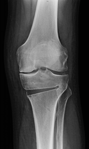 image_2022-10-05_235317789