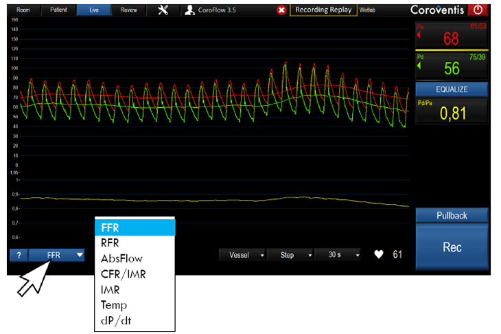 cmd-coroflow-hemodynamic-image-bonameda