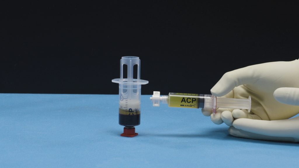 Arthrex-PRP™ injekcija